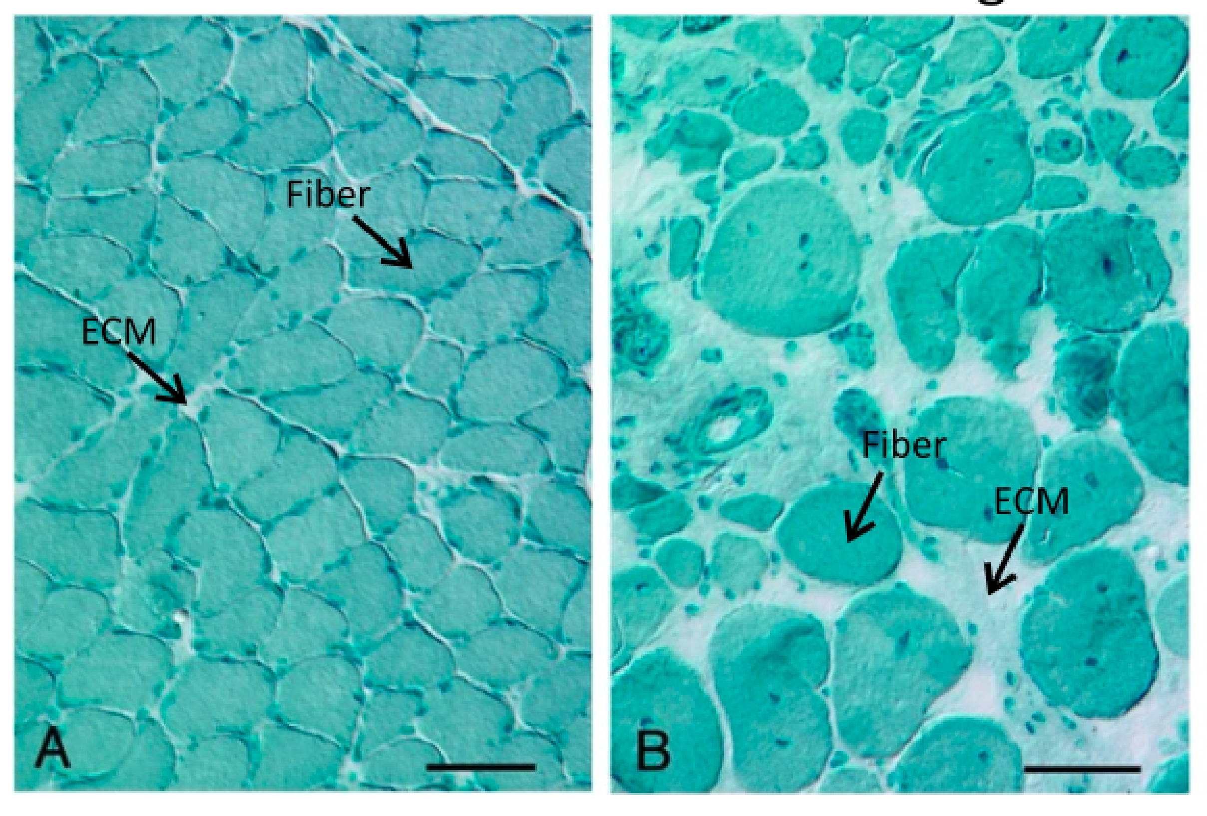 Comparison of healthy and pathological tissue
